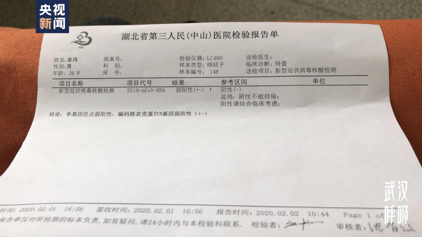 加重,出现了呼吸困难甚至咳血的情况;2月3日,他的核酸检查结果为阳性