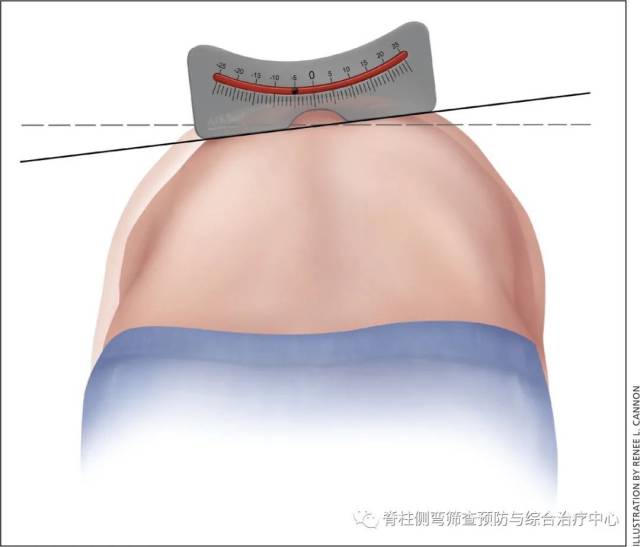 60ce96751ca4d.jpg