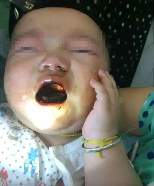 深圳一男孩误食药品中毒